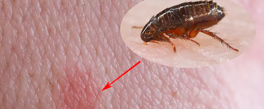 Flea Control for Humans San Bernardino, CA